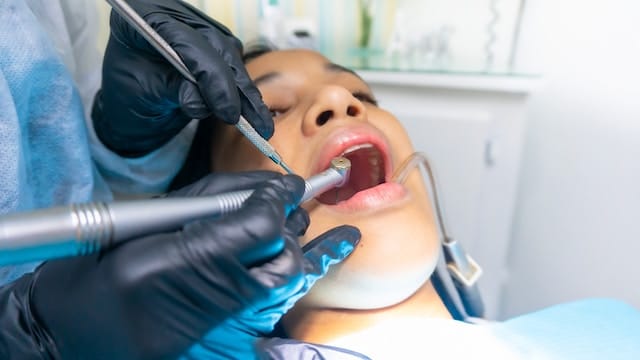 Endodoncja – Leczenie kanałowe zęba: Ocal swój naturalny uśmiech